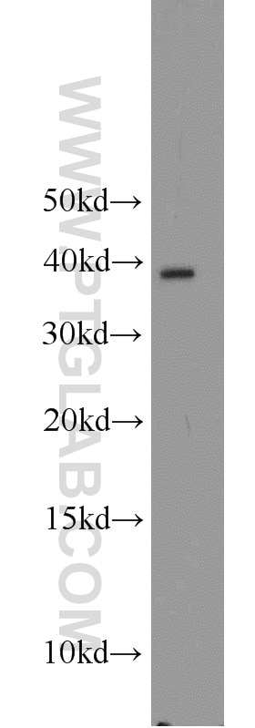 Western Blot (WB) analysis of HeLa cells using APOL1 Polyclonal antibody (11486-2-AP)