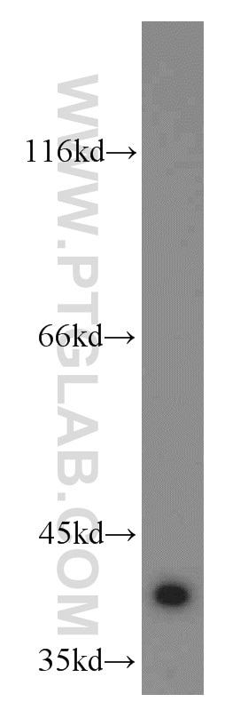 Western Blot (WB) analysis of A2780 cells using APOL1 Polyclonal antibody (11486-2-AP)