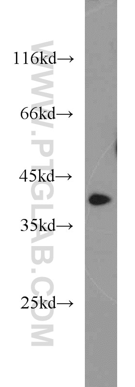 Western Blot (WB) analysis of human plasma using APOL1 Polyclonal antibody (11486-2-AP)