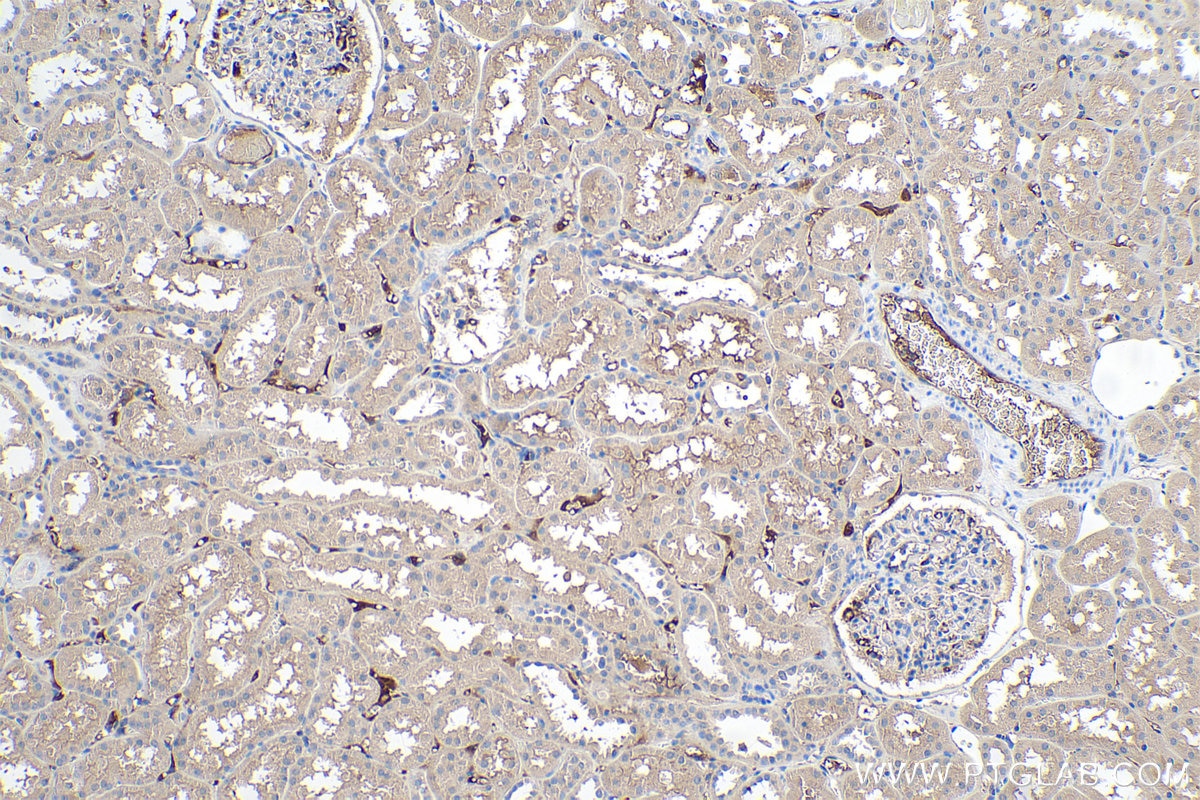 Immunohistochemistry (IHC) staining of human kidney tissue using APOL1-Specific Monoclonal antibody (66124-1-Ig)