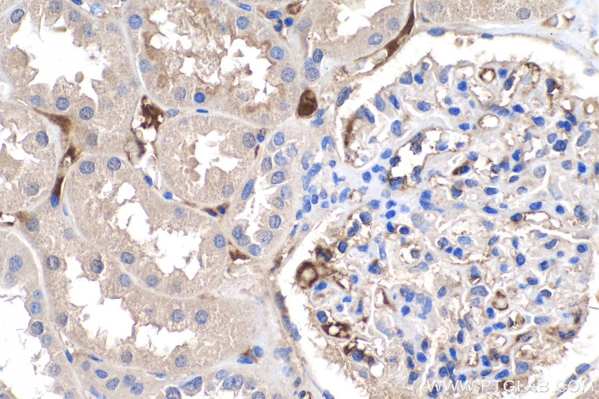 Immunohistochemistry (IHC) staining of human kidney tissue using APOL1-Specific Monoclonal antibody (66124-1-Ig)