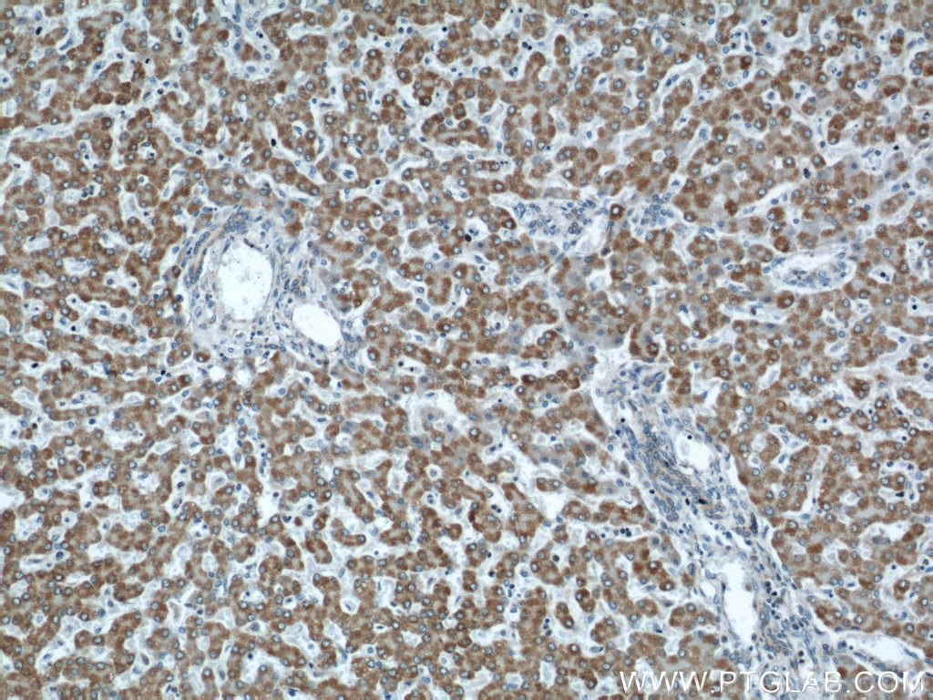 Immunohistochemistry (IHC) staining of human liver tissue using APOL1-Specific Monoclonal antibody (66124-1-Ig)