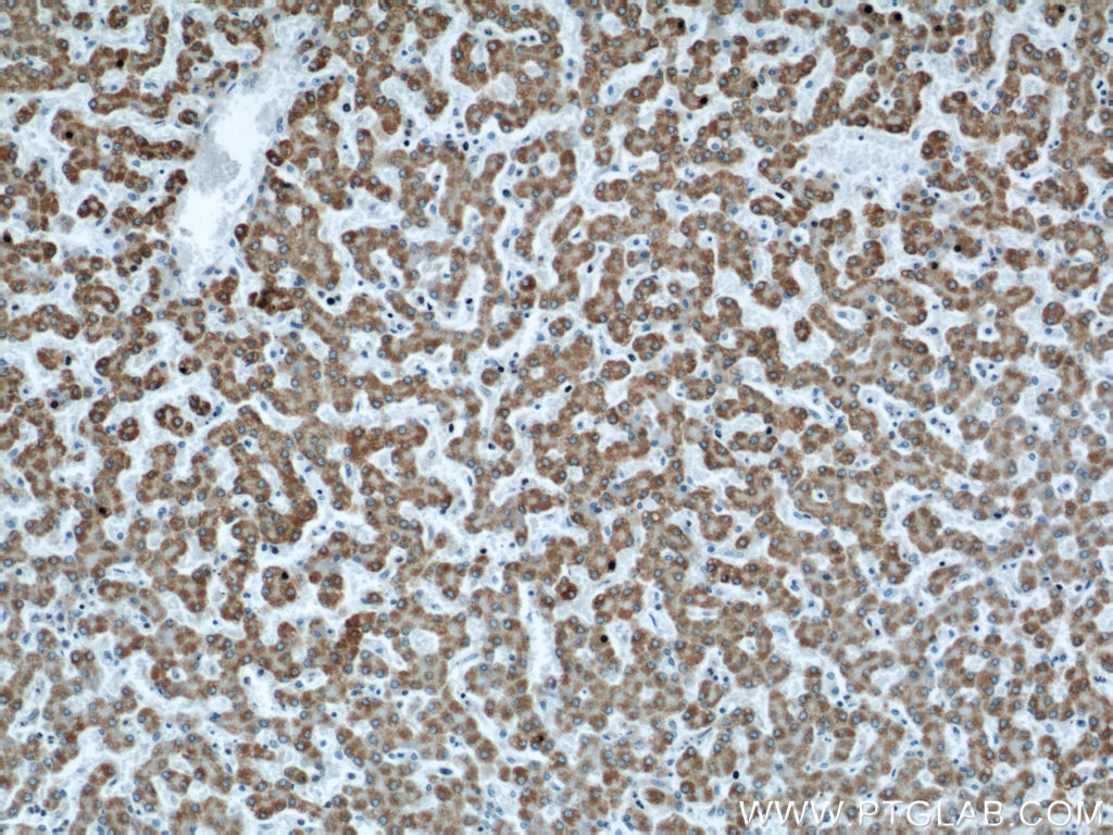 IHC staining of human liver using 66124-1-Ig
