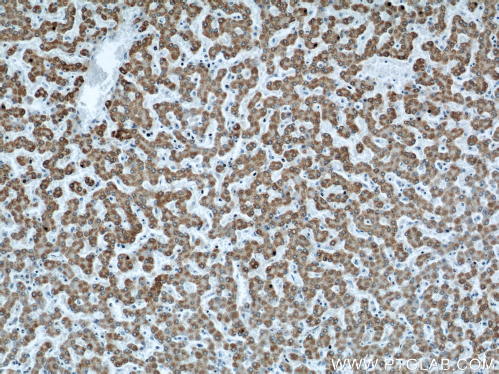 Immunohistochemistry (IHC) staining of human liver tissue using APOL1-Specific Monoclonal antibody (66124-1-Ig)