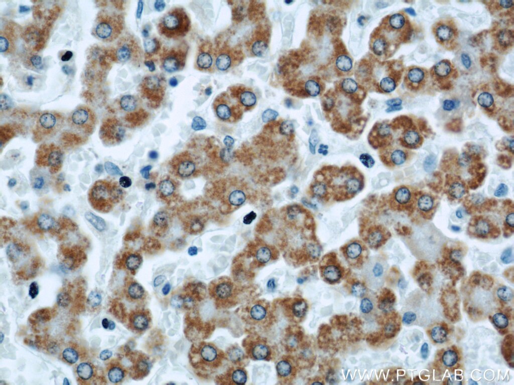 Immunohistochemistry (IHC) staining of human liver tissue using APOL1-Specific Monoclonal antibody (66124-1-Ig)