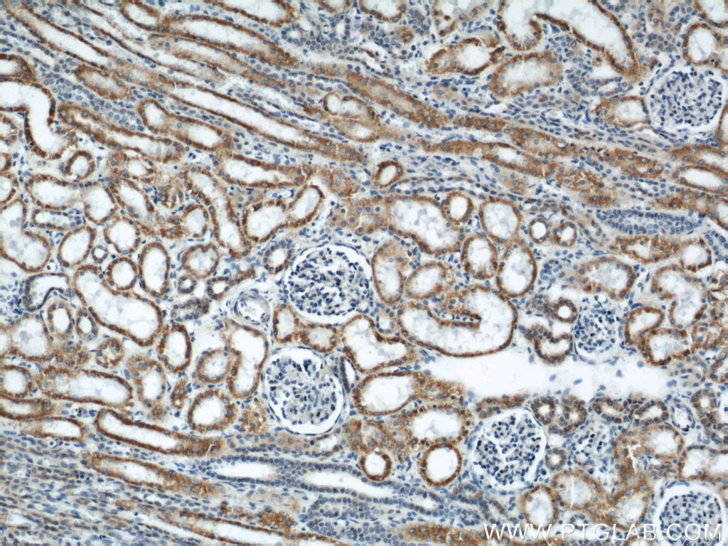 Immunohistochemistry (IHC) staining of human kidney tissue using APOL1-Specific Monoclonal antibody (66124-1-Ig)