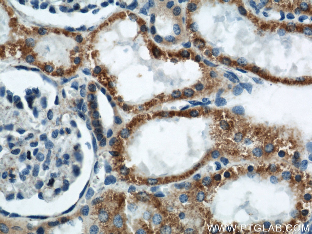 Immunohistochemistry (IHC) staining of human kidney tissue using APOL1-Specific Monoclonal antibody (66124-1-Ig)