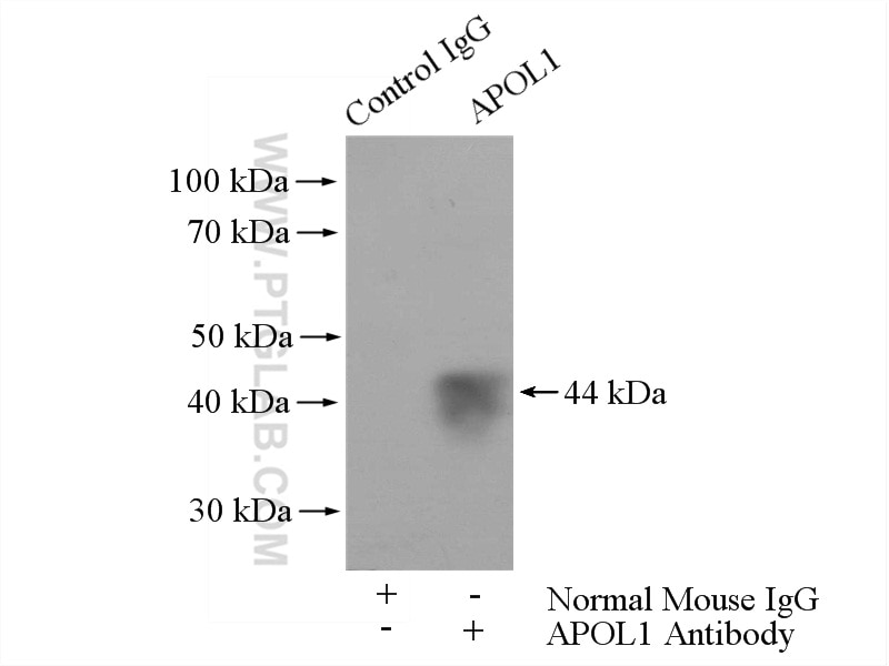 Immunoprecipitation (IP) experiment of human plasma using APOL1-Specific Monoclonal antibody (66124-1-Ig)