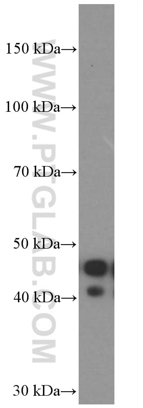 Western Blot (WB) analysis of human plasma using APOL1-Specific Monoclonal antibody (66124-1-Ig)