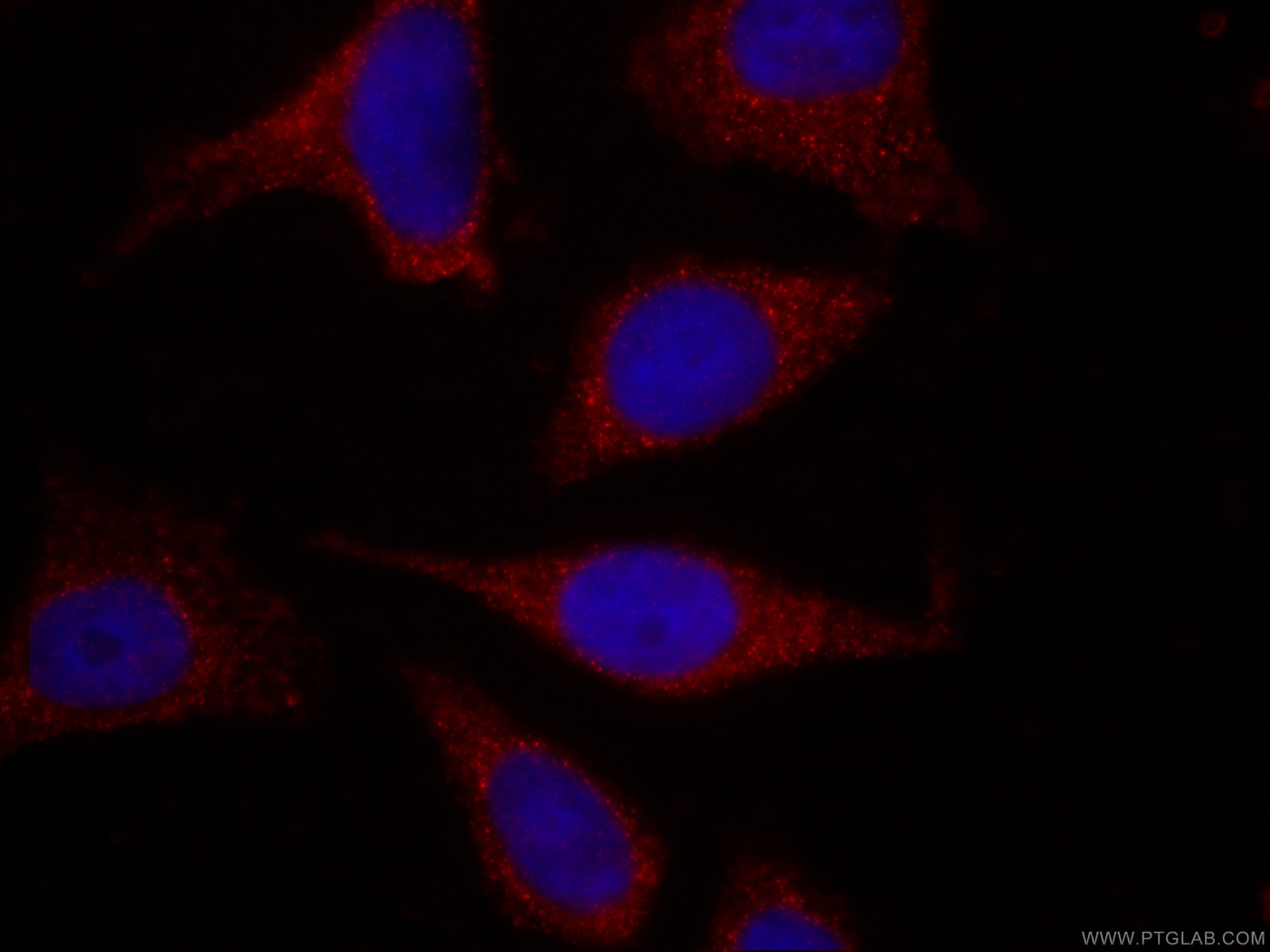 APOL1-Specific