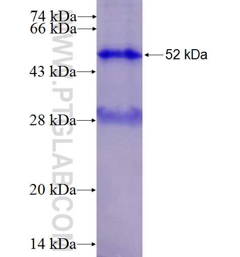 APOL1 fusion protein Ag2016 SDS-PAGE