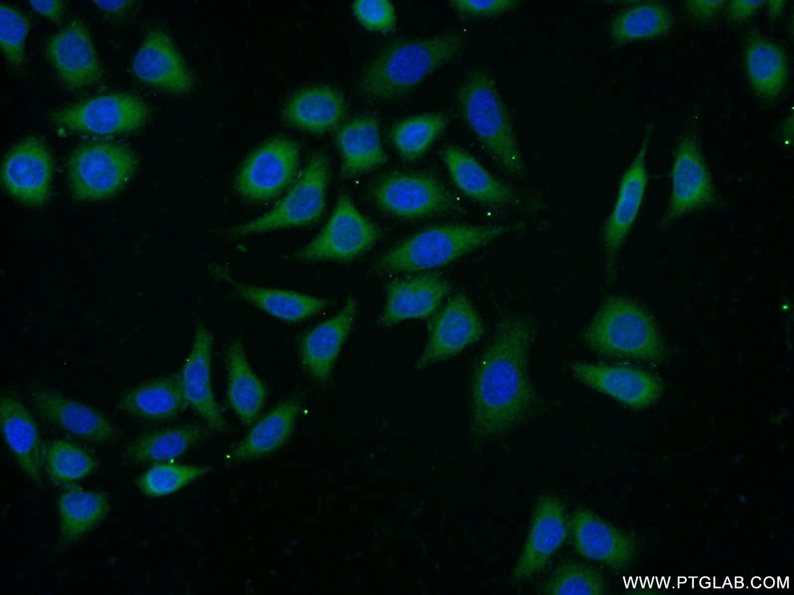 Immunofluorescence (IF) / fluorescent staining of HeLa cells using APOL2 Polyclonal antibody (25925-1-AP)