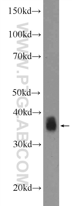 Western Blot (WB) analysis of HeLa cells using APOL2 Polyclonal antibody (25925-1-AP)