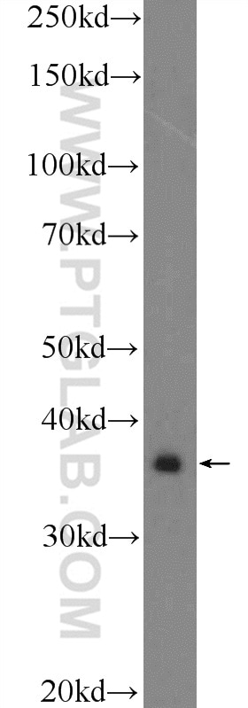 Western Blot (WB) analysis of A431 cells using APOL2 Polyclonal antibody (25925-1-AP)