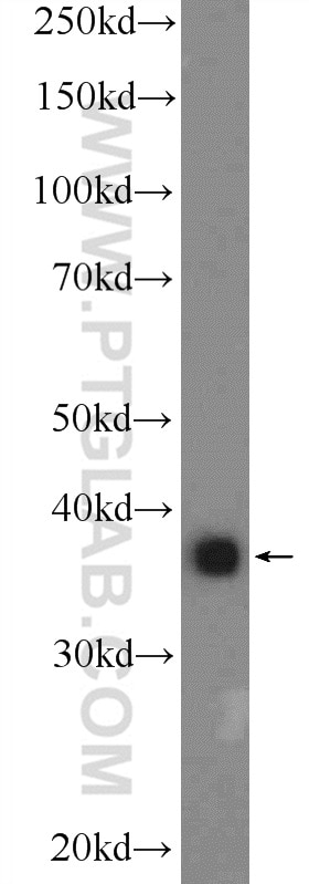 Western Blot (WB) analysis of A549 cells using APOL2 Polyclonal antibody (25925-1-AP)