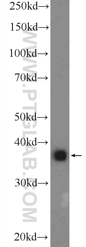 Western Blot (WB) analysis of A549 cells using APOL2 Polyclonal antibody (25925-1-AP)