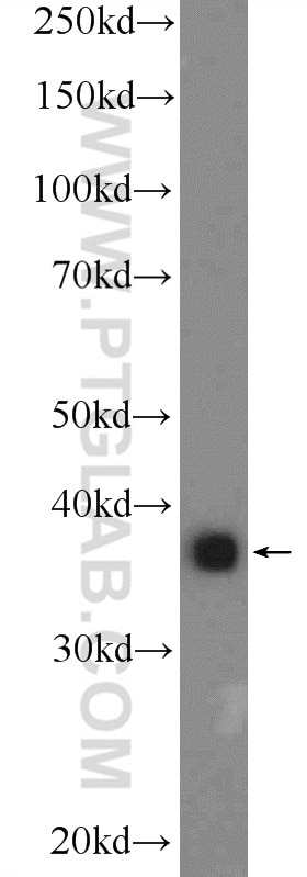 WB analysis of A549 using 25925-1-AP