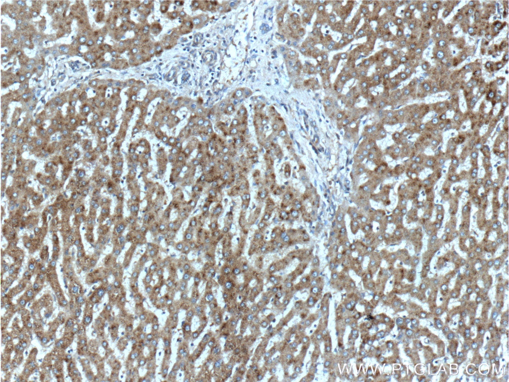 Immunohistochemistry (IHC) staining of human liver tissue using APOL4 Polyclonal antibody (10564-1-AP)