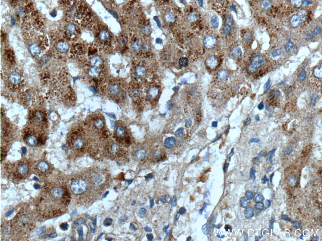 Immunohistochemistry (IHC) staining of human liver tissue using APOL4 Polyclonal antibody (10564-1-AP)