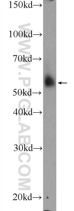 Western Blot (WB) analysis of human placenta tissue using APOL4 Polyclonal antibody (10564-1-AP)