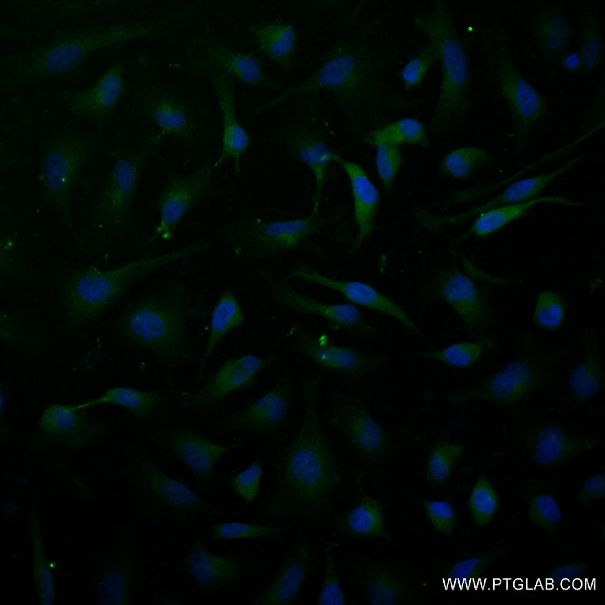 Immunofluorescence (IF) / fluorescent staining of HeLa cells using APOL6 Recombinant antibody (82877-2-RR)