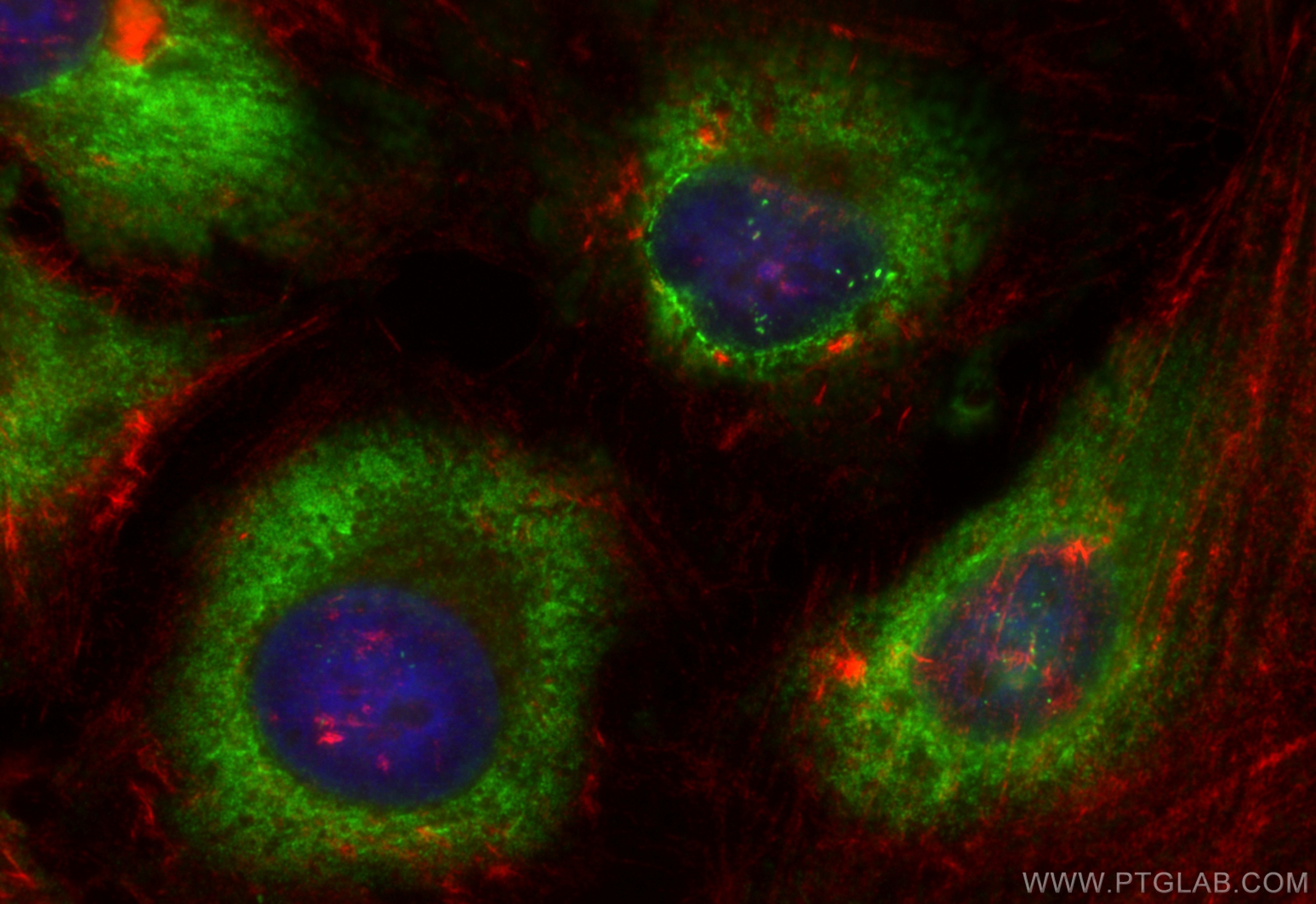 Immunofluorescence (IF) / fluorescent staining of HeLa cells using CoraLite® Plus 488-conjugated APOL6 Recombinant an (CL488-82877-2)