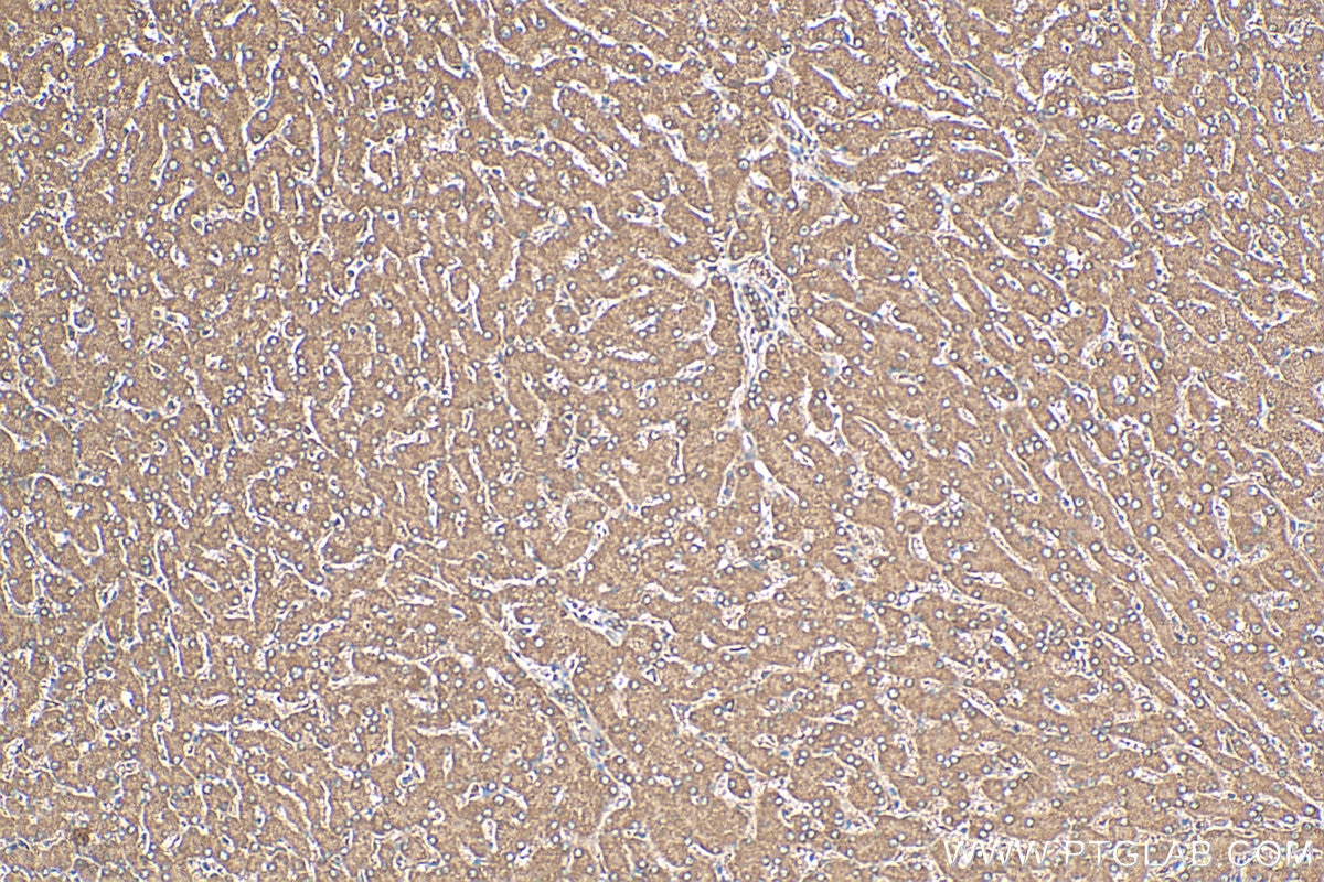 Immunohistochemistry (IHC) staining of human liver tissue using APOM Polyclonal antibody (12817-1-AP)