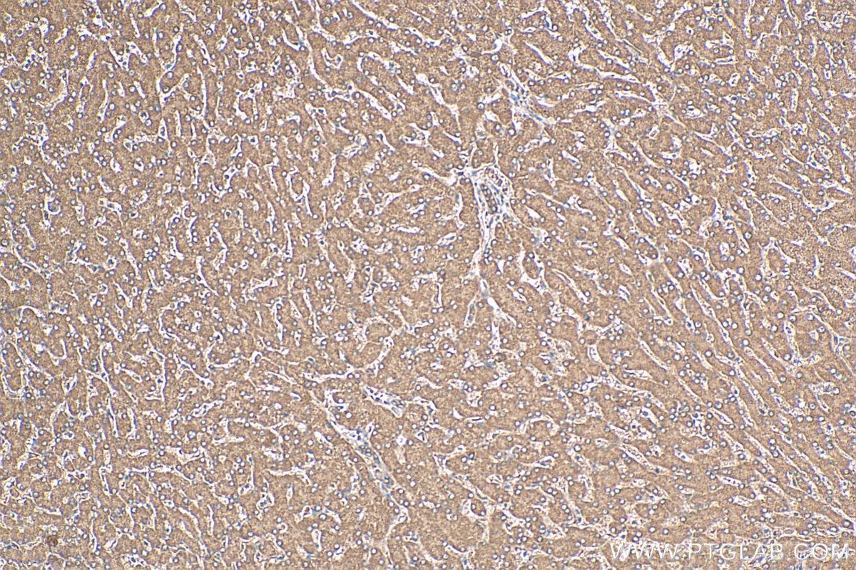 IHC staining of human liver using 12817-1-AP