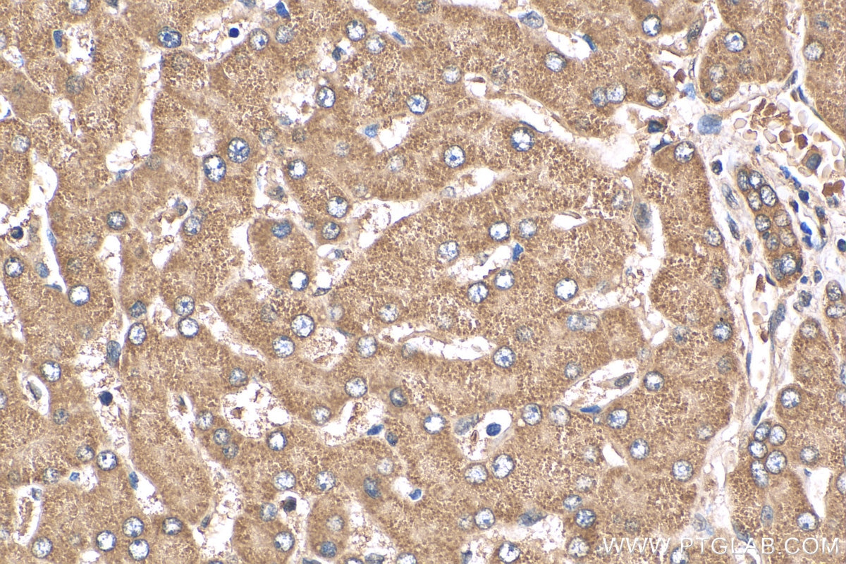 IHC staining of human liver using 12817-1-AP