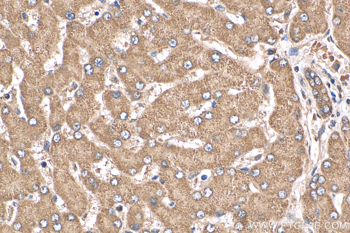 Immunohistochemistry (IHC) staining of human liver tissue using APOM Polyclonal antibody (12817-1-AP)