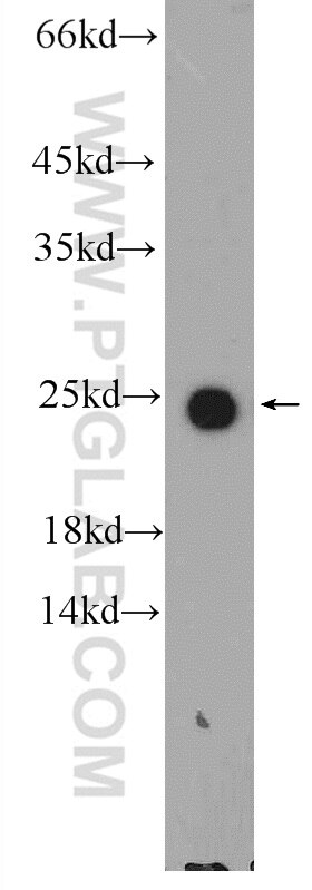 Western Blot (WB) analysis of human plasma using APOM Polyclonal antibody (12817-1-AP)