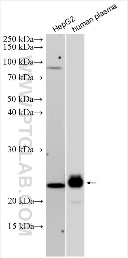 Western Blot (WB) analysis of various lysates using APOM Polyclonal antibody (12817-1-AP)