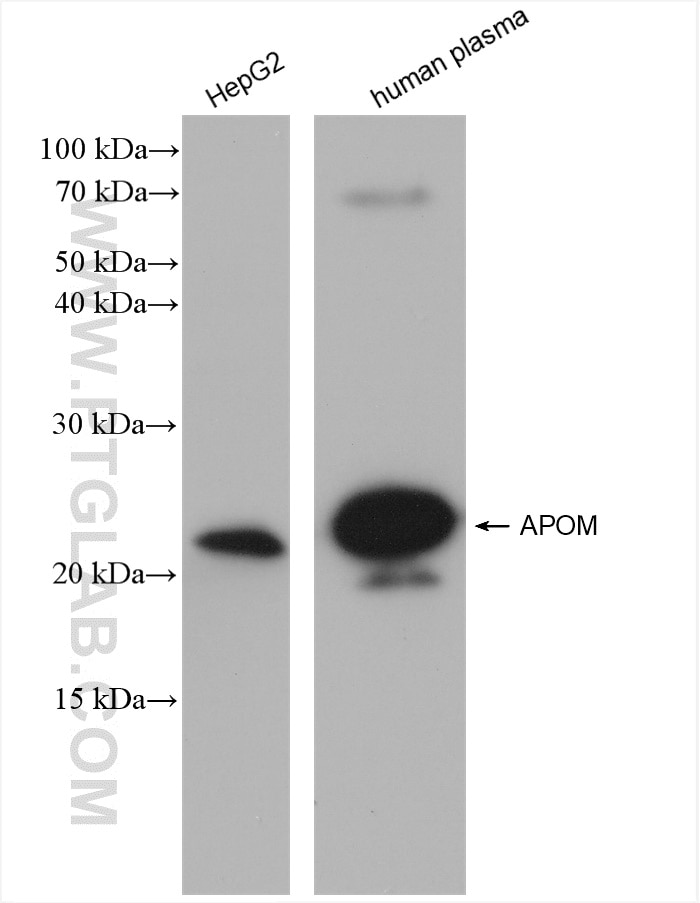 Western Blot (WB) analysis of various lysates using APOM Recombinant antibody (82871-1-RR)