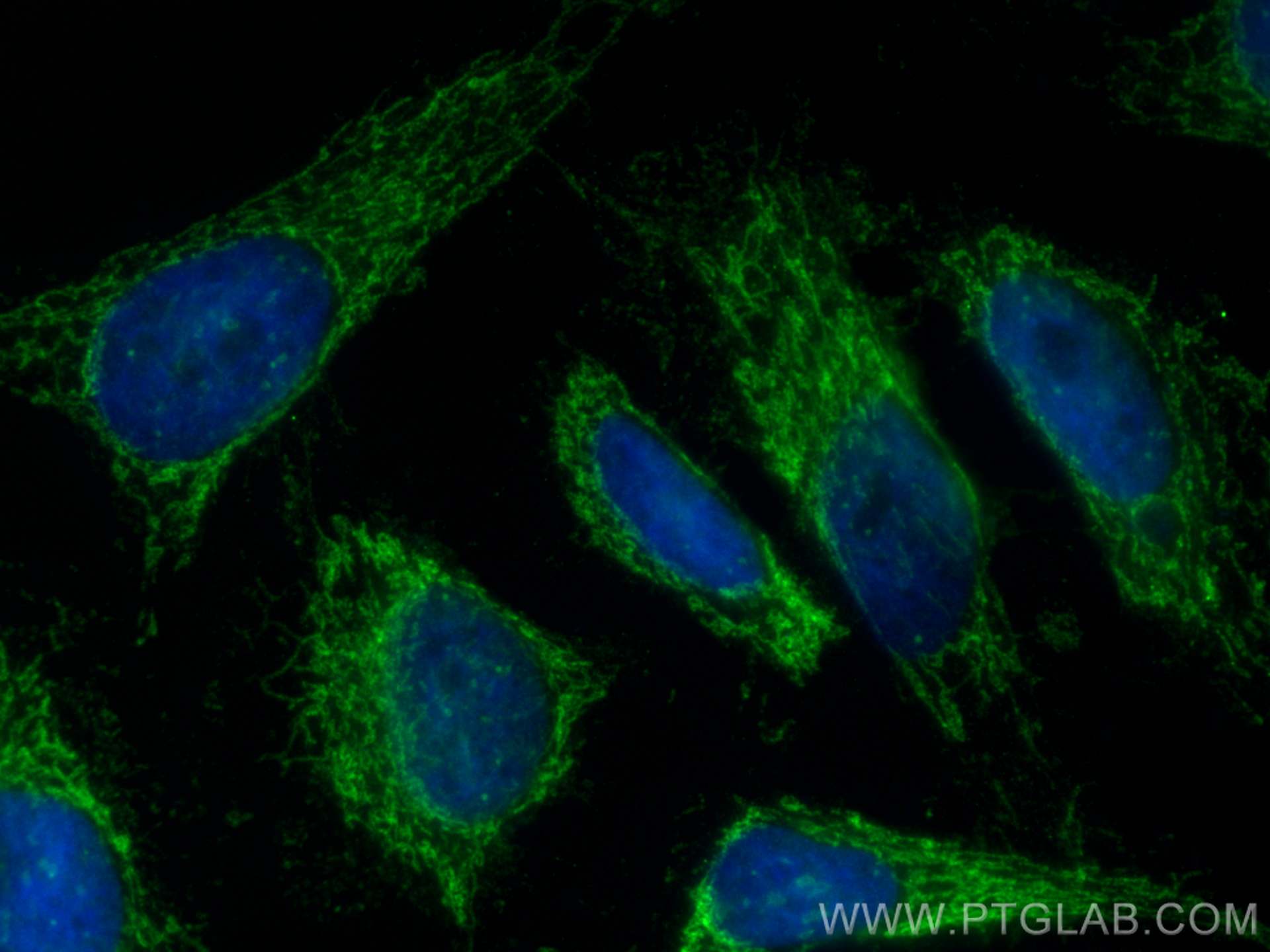 Immunofluorescence (IF) / fluorescent staining of HeLa cells using APOOL Polyclonal antibody (28514-1-AP)