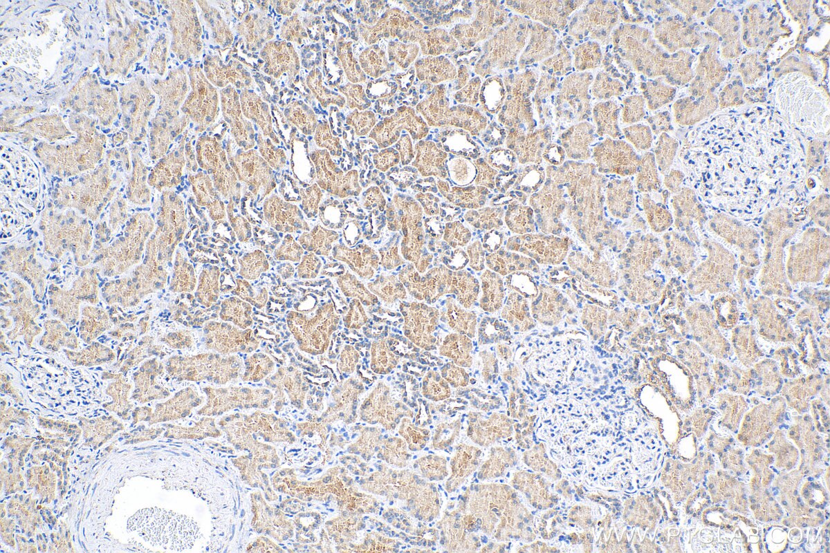 Immunohistochemistry (IHC) staining of human kidney tissue using APOOL Polyclonal antibody (28514-1-AP)