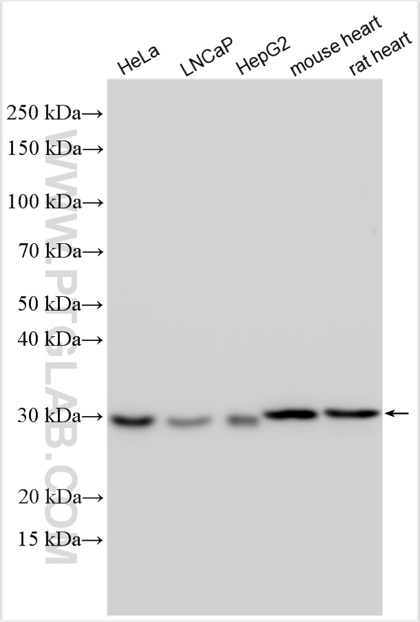 Western Blot (WB) analysis of various lysates using APOOL Polyclonal antibody (28514-1-AP)