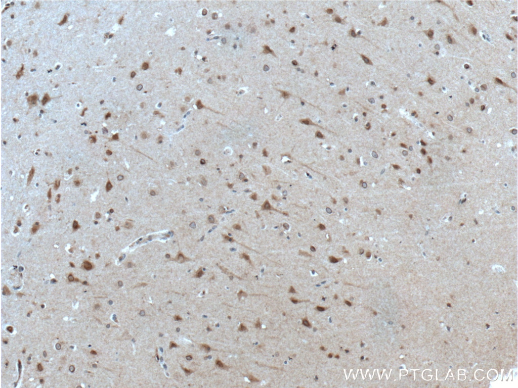 Immunohistochemistry (IHC) staining of human brain tissue using APP Polyclonal antibody (10524-1-AP)