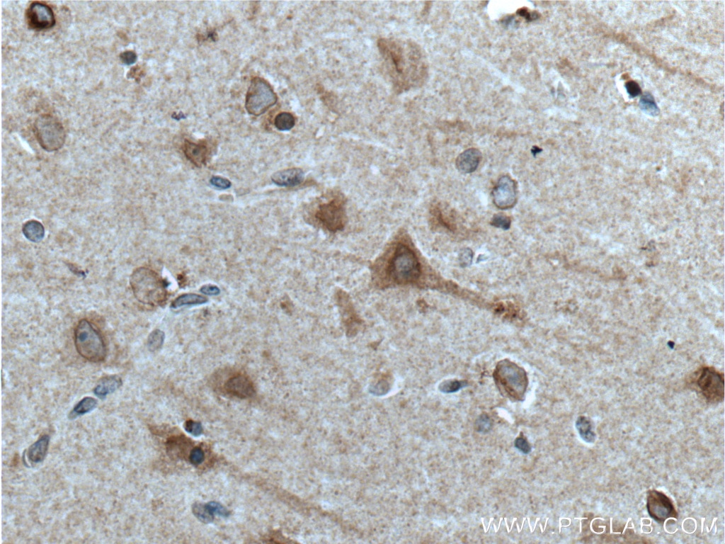 Immunohistochemistry (IHC) staining of human brain tissue using APP Polyclonal antibody (10524-1-AP)