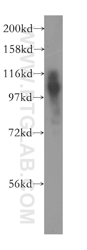 APP Polyclonal antibody