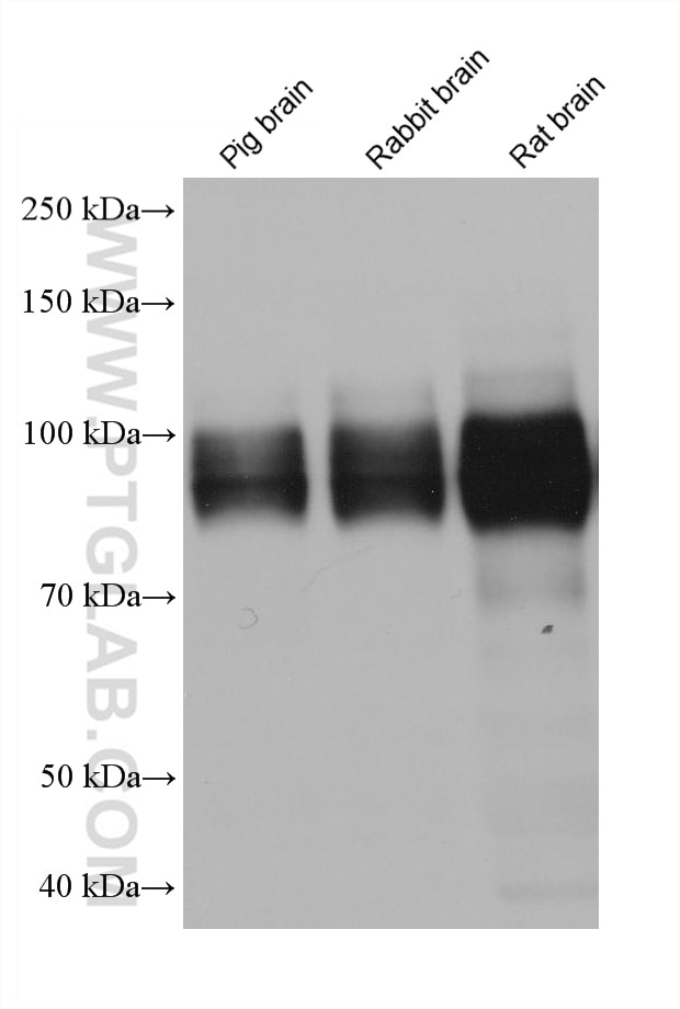 Western Blot (WB) analysis of various lysates using APP Monoclonal antibody (60342-1-Ig)
