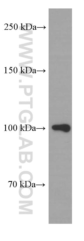 Western Blot (WB) analysis of Y79 cells using APP Monoclonal antibody (60342-1-Ig)
