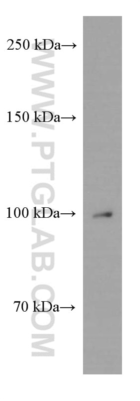 Western Blot (WB) analysis of HEK-293 cells using APP Monoclonal antibody (60342-1-Ig)