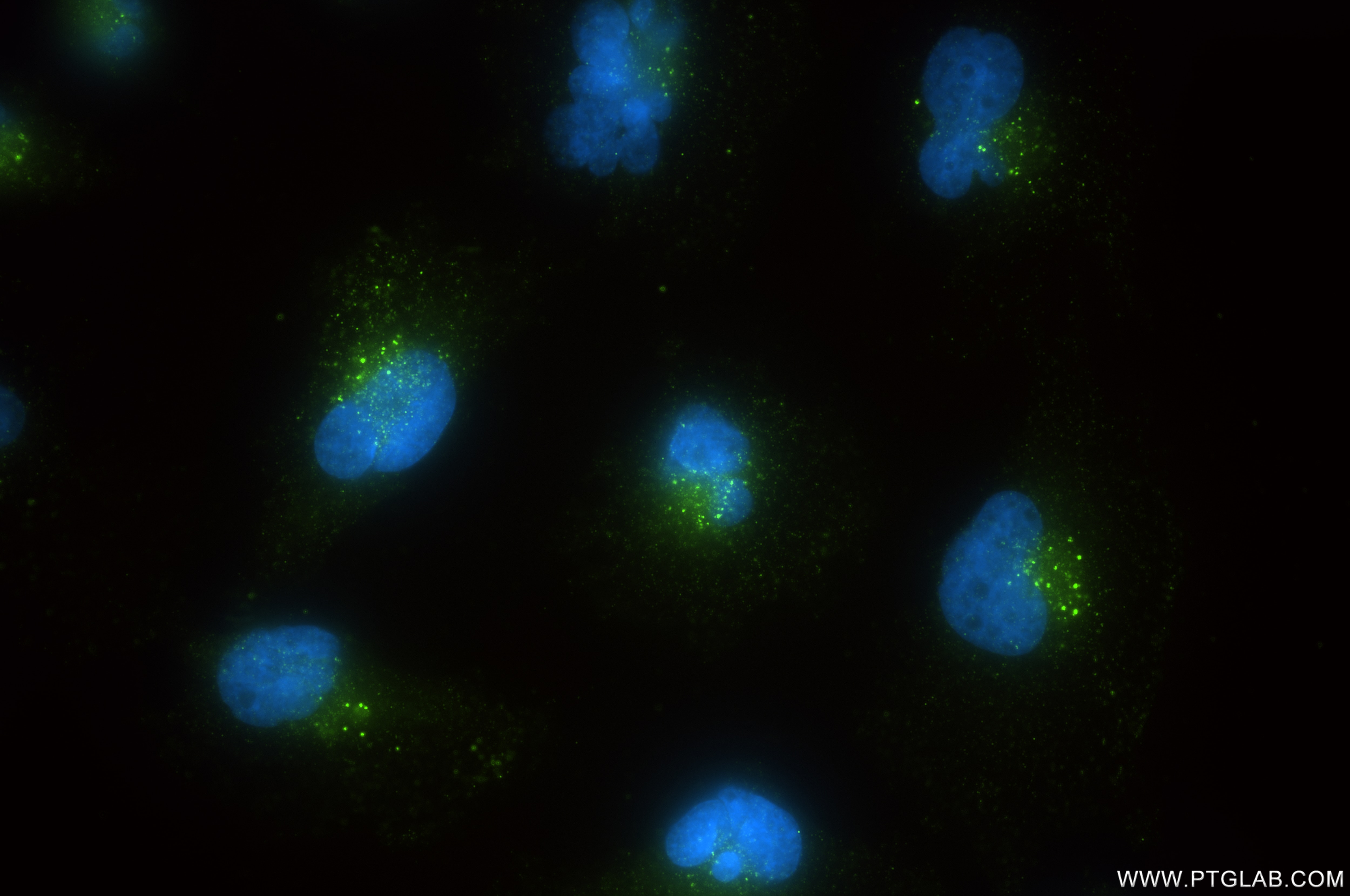 Immunofluorescence (IF) / fluorescent staining of U-251 cells using APP Recombinant antibody (84829-6-RR)