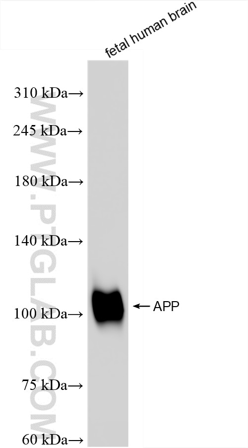 Western Blot (WB) analysis of fetal human brain tissue using APP Recombinant antibody (84829-6-RR)