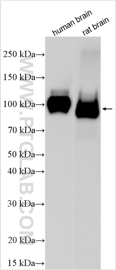 Western Blot (WB) analysis of various lysates using APP Recombinant antibody (84829-6-RR)