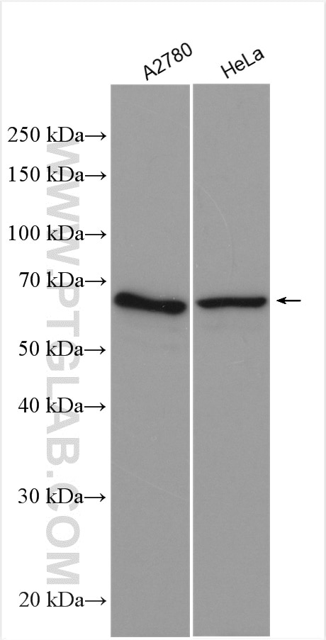 Western Blot (WB) analysis of various lysates using APPBP2 Polyclonal antibody (12409-1-AP)