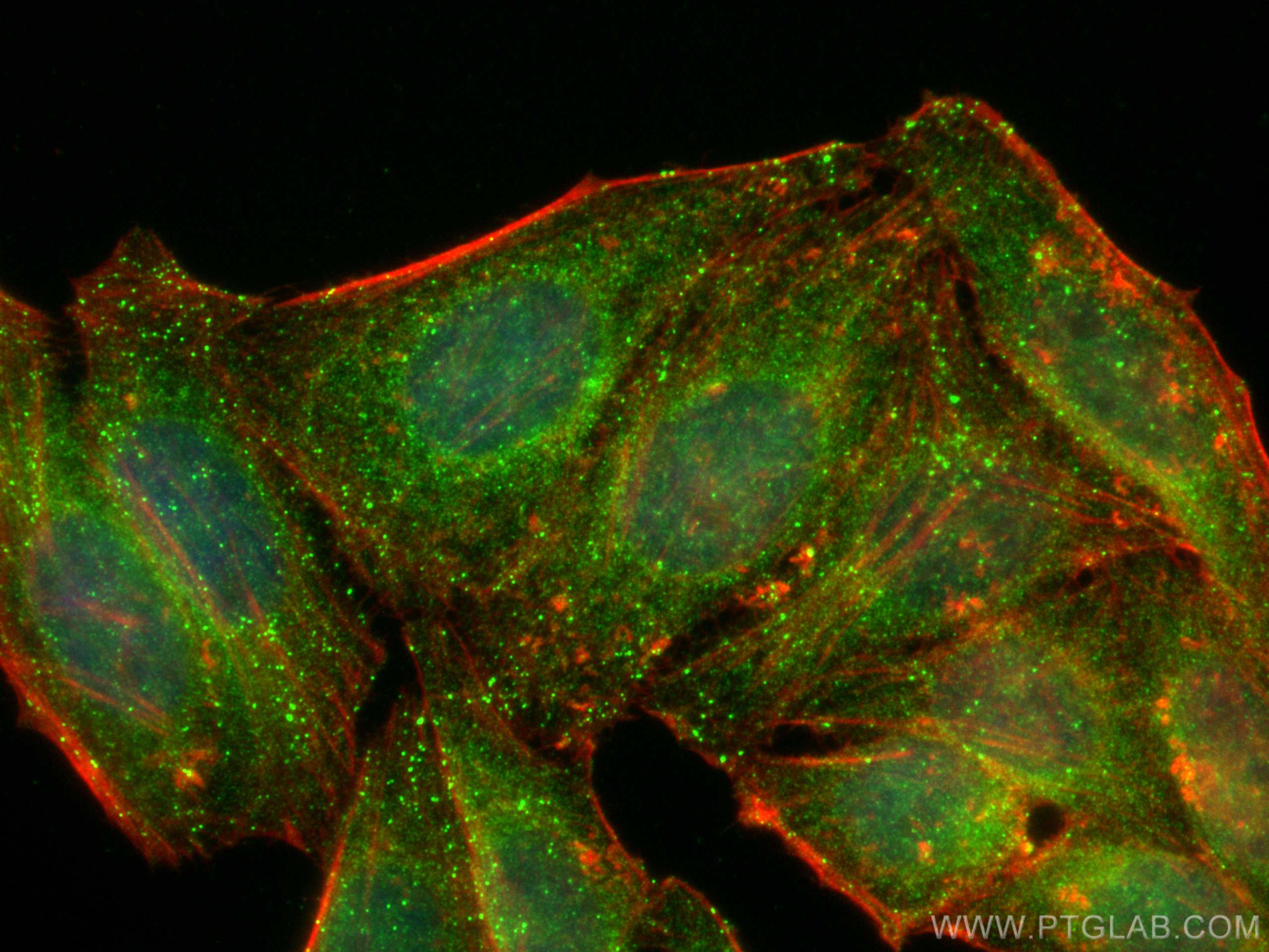 Immunofluorescence (IF) / fluorescent staining of HepG2 cells using APPL1 Polyclonal antibody (12639-1-AP)