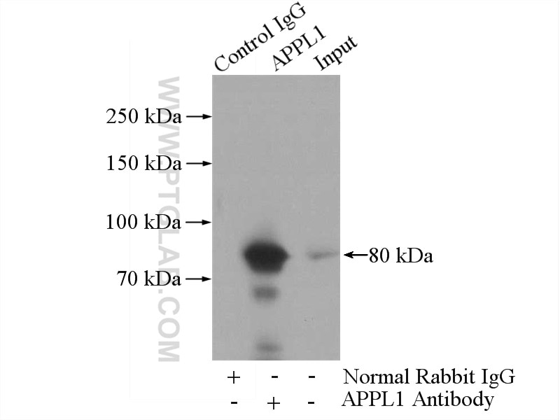 IP experiment of mouse brain using 12639-1-AP