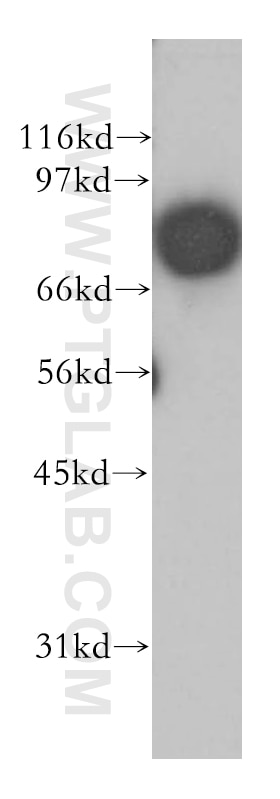 Western Blot (WB) analysis of mouse ovary tissue using APPL1 Polyclonal antibody (12639-1-AP)