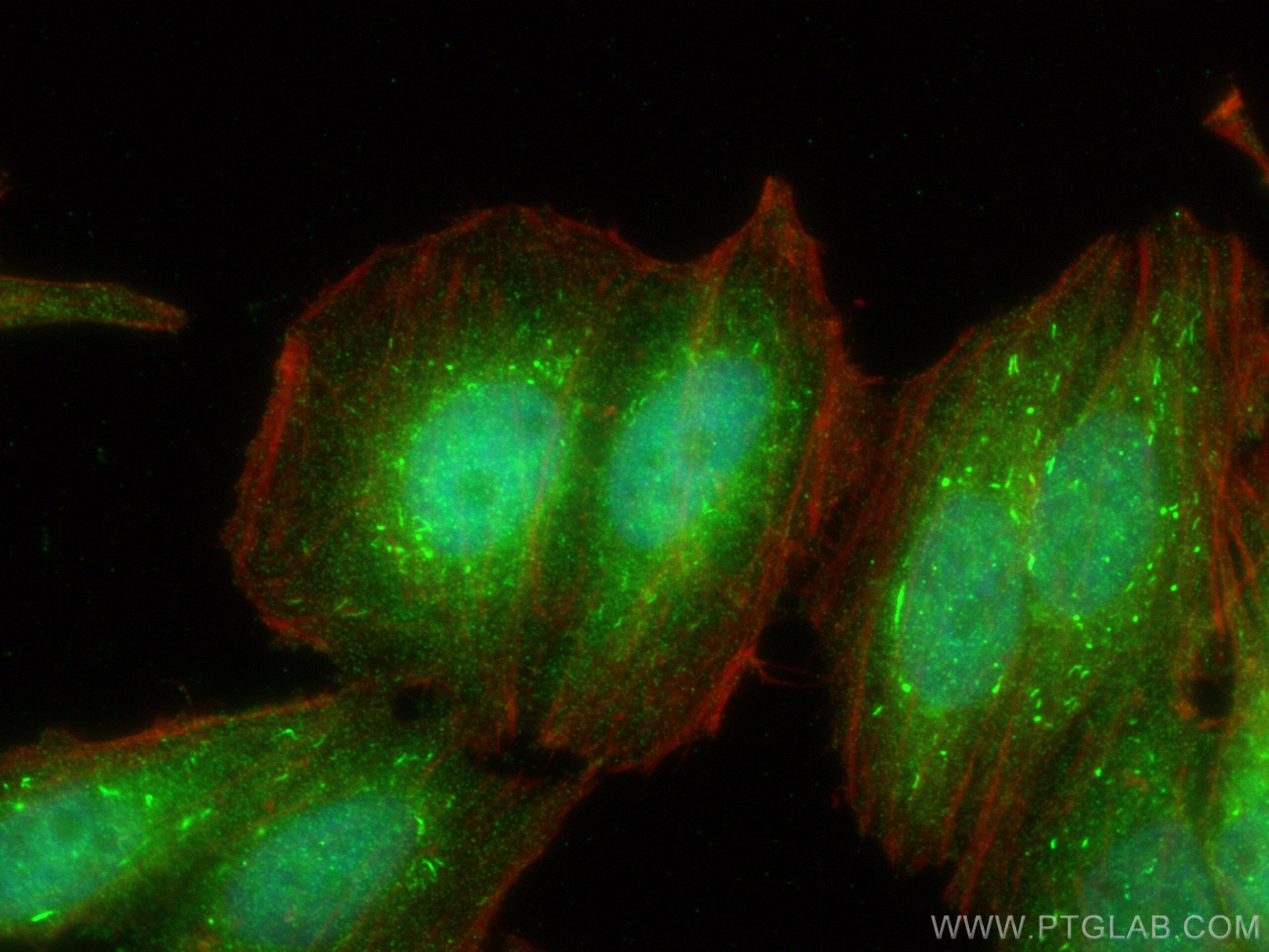 Immunofluorescence (IF) / fluorescent staining of HepG2 cells using APPL1 Polyclonal antibody (19885-1-AP)